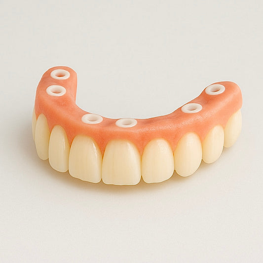 Full Arch Implant Bridge: Zirconia (12 units)
